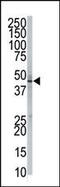 Phosphatidylinositol Glycan Anchor Biosynthesis Class K antibody, 61-396, ProSci, Western Blot image 