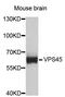 Vacuolar Protein Sorting 45 Homolog antibody, STJ26699, St John