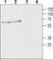 Solute Carrier Family 18 Member A3 antibody, TA328797, Origene, Western Blot image 