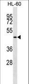Keratin 28 antibody, LS-C165623, Lifespan Biosciences, Western Blot image 