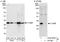 p33 antibody, A302-862A, Bethyl Labs, Immunoprecipitation image 