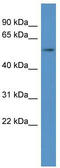 Aldehyde Dehydrogenase 1 Family Member A2 antibody, TA342736, Origene, Western Blot image 