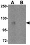 Piwi Like RNA-Mediated Gene Silencing 3 antibody, GTX85145, GeneTex, Western Blot image 