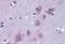 Tripartite Motif Containing 2 antibody, orb18436, Biorbyt, Immunohistochemistry paraffin image 