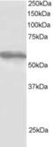 Tripartite Motif Containing 4 antibody, EB05931, Everest Biotech, Western Blot image 