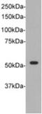 DNA Nucleotidylexotransferase antibody, NBP2-67185, Novus Biologicals, Western Blot image 