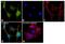 Pyruvate Kinase M1/2 antibody, PA5-23034, Invitrogen Antibodies, Immunocytochemistry image 