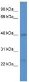 Guided Entry Of Tail-Anchored Proteins Factor 3, ATPase antibody, TA342874, Origene, Western Blot image 