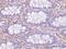 P21 (RAC1) Activated Kinase 4 antibody, PA5-20233, Invitrogen Antibodies, Immunohistochemistry frozen image 