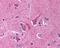 Slit Guidance Ligand 1 antibody, 49-594, ProSci, Immunohistochemistry paraffin image 