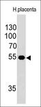 Ornithine Decarboxylase 1 antibody, GTX34919, GeneTex, Western Blot image 