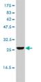 Uroporphyrinogen III Synthase antibody, H00007390-M01, Novus Biologicals, Western Blot image 