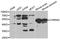 Cholinergic Receptor Nicotinic Alpha 5 Subunit antibody, A1741, ABclonal Technology, Western Blot image 