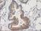 Pleckstrin Homology Domain Containing A3 antibody, LS-C172961, Lifespan Biosciences, Immunohistochemistry paraffin image 