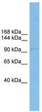 Coatomer Protein Complex Subunit Gamma 1 antibody, TA333781, Origene, Western Blot image 