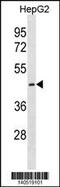 Cystinosin, Lysosomal Cystine Transporter antibody, 60-528, ProSci, Western Blot image 