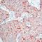 TIMP Metallopeptidase Inhibitor 1 antibody, MA5-13685, Invitrogen Antibodies, Immunohistochemistry paraffin image 