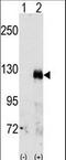 EPH Receptor A3 antibody, LS-C100258, Lifespan Biosciences, Western Blot image 