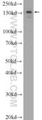 ATPase Family AAA Domain Containing 2 antibody, 23894-1-AP, Proteintech Group, Western Blot image 