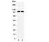 Glutamate Ionotropic Receptor AMPA Type Subunit 3 antibody, R31373, NSJ Bioreagents, Western Blot image 