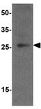 Phosducin Like 3 antibody, GTX32137, GeneTex, Western Blot image 