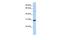 Metaxin 2 antibody, GTX45847, GeneTex, Western Blot image 