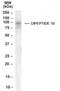 Inactive dipeptidyl peptidase 10 antibody, NB100-1511, Novus Biologicals, Western Blot image 