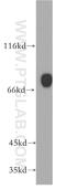 Adhesion G Protein-Coupled Receptor E5 antibody, 13071-1-AP, Proteintech Group, Western Blot image 