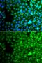 Zinc Finger Protein 195 antibody, GTX32980, GeneTex, Immunofluorescence image 