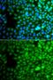 Zinc Finger Protein 195 antibody, GTX32980, GeneTex, Immunofluorescence image 
