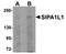 Signal Induced Proliferation Associated 1 Like 1 antibody, orb75312, Biorbyt, Western Blot image 