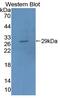 FUS RNA Binding Protein antibody, abx129140, Abbexa, Western Blot image 
