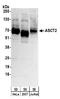Solute Carrier Family 1 Member 5 antibody, A304-353A, Bethyl Labs, Western Blot image 