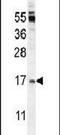 TNF Superfamily Member 4 antibody, PA5-24552, Invitrogen Antibodies, Western Blot image 