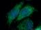 Translocase Of Outer Mitochondrial Membrane 22 antibody, 11278-1-AP, Proteintech Group, Immunofluorescence image 