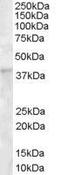 Dickkopf WNT Signaling Pathway Inhibitor 1 antibody, GTX89683, GeneTex, Western Blot image 