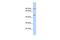 Potassium Voltage-Gated Channel Subfamily J Member 8 antibody, PA5-41028, Invitrogen Antibodies, Western Blot image 