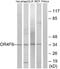 Olfactory Receptor Family 4 Subfamily F Member 6 antibody, A17550, Boster Biological Technology, Western Blot image 