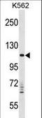 VPS11 Core Subunit Of CORVET And HOPS Complexes antibody, LS-C160536, Lifespan Biosciences, Western Blot image 