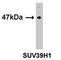 Suppressor Of Variegation 3-9 Homolog 1 antibody, F40197-0.4ML, NSJ Bioreagents, Western Blot image 