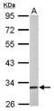 Musashi RNA Binding Protein 2 antibody, GTX117808, GeneTex, Western Blot image 