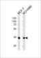 Tafazzin antibody, GTX81015, GeneTex, Western Blot image 