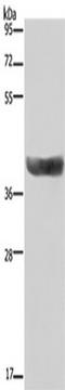 Hydroxysteroid 17-Beta Dehydrogenase 2 antibody, TA350060, Origene, Western Blot image 