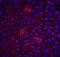 Fli-1 Proto-Oncogene, ETS Transcription Factor antibody, NBP1-77016, Novus Biologicals, Immunohistochemistry paraffin image 