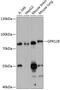 Probable G-protein coupled receptor 128 antibody, 15-537, ProSci, Western Blot image 