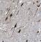 Fibronectin Type III And SPRY Domain Containing 1 Like antibody, FNab03229, FineTest, Immunohistochemistry paraffin image 