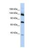 Phospholipase A2 Group IVB antibody, NBP1-80112, Novus Biologicals, Western Blot image 