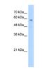 Transmembrane Phosphatase With Tensin Homology antibody, NBP1-58242, Novus Biologicals, Western Blot image 