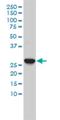 Carbonic Anhydrase 3 antibody, H00000761-M02, Novus Biologicals, Western Blot image 