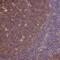 Tubulin Beta 1 Class VI antibody, NBP2-54728, Novus Biologicals, Immunohistochemistry paraffin image 